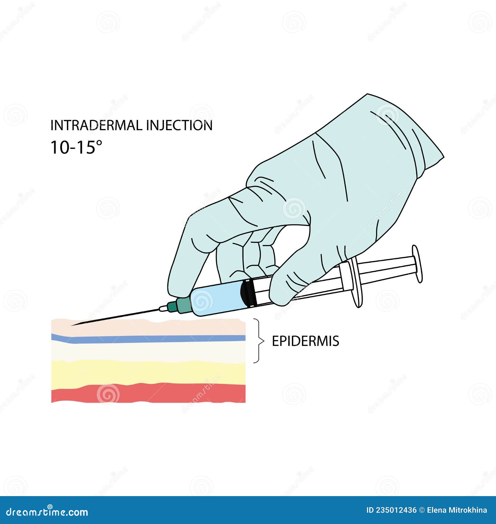 intradermal injection. effective methods of administration of drugs and other medical solutions that are used.