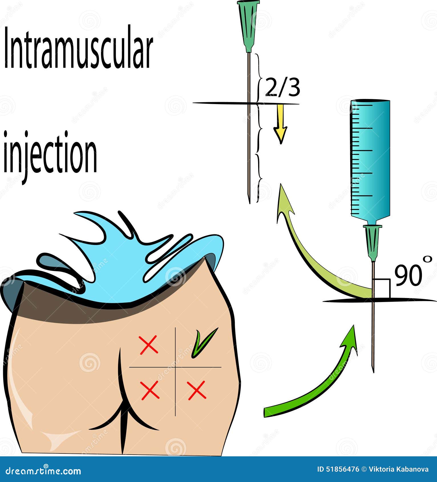 intramuscular injection. rules.