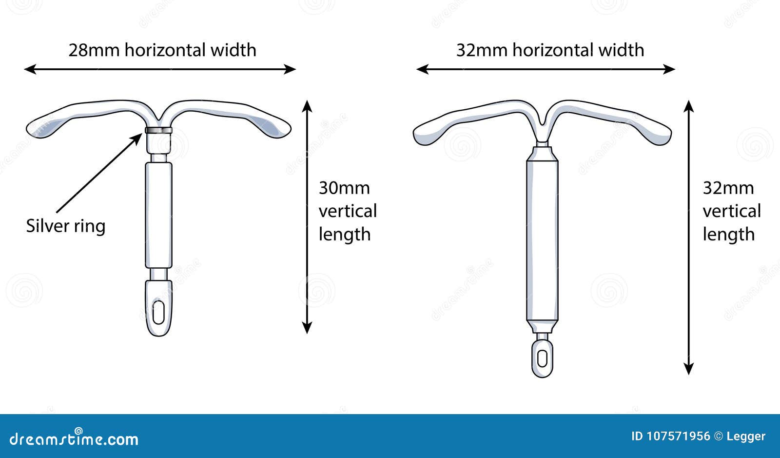 intrauterine device iud