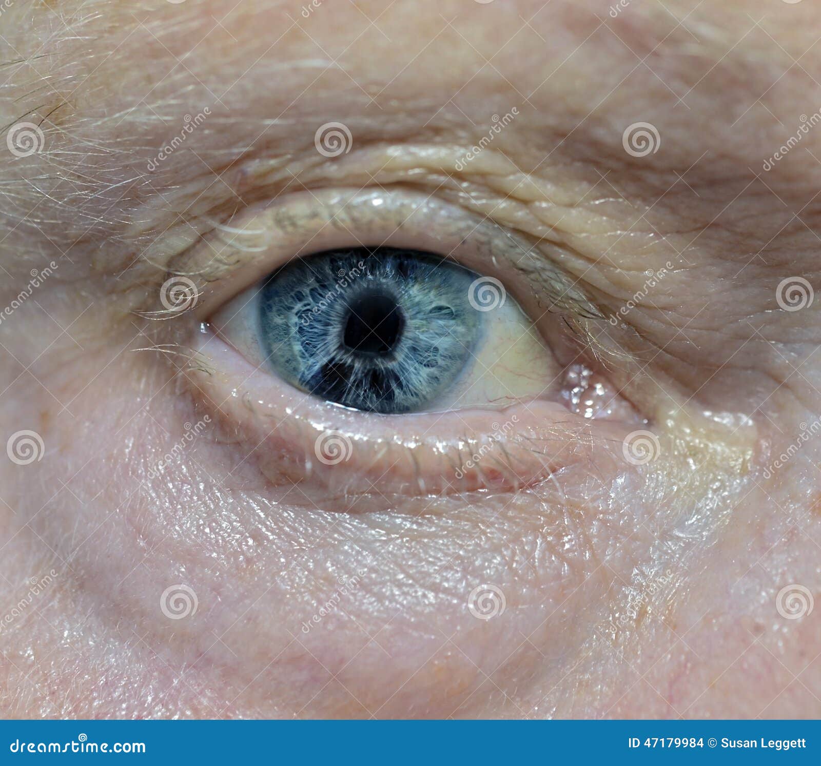 My Image 25