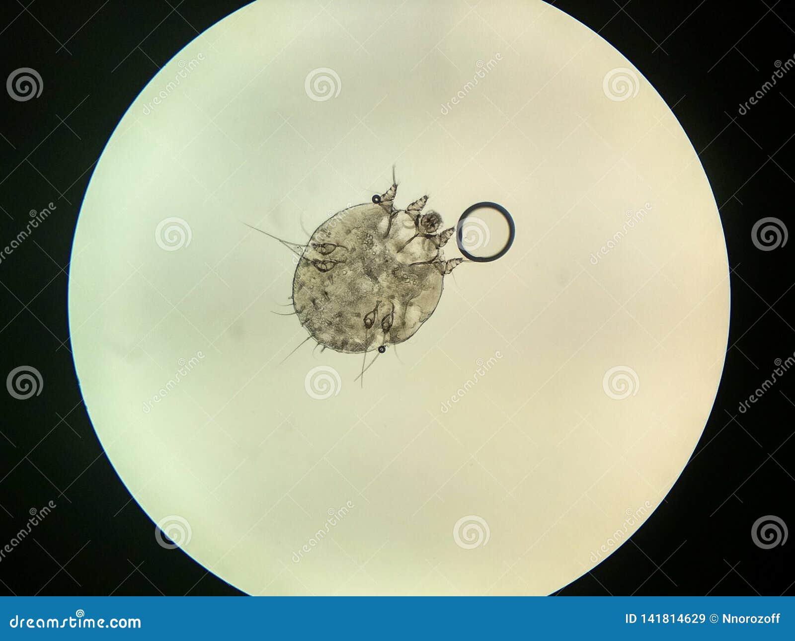 Itchmite, Parasitic of Human Skin Stock Image Image of