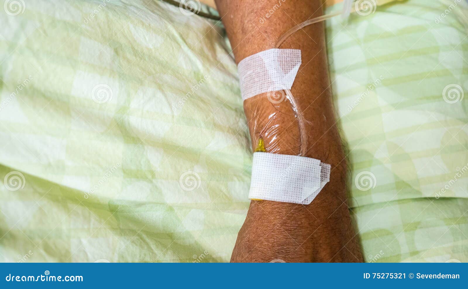 IV needle on patient arm. stock image. Image of health 75275321