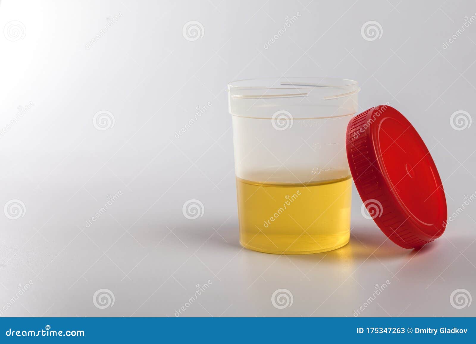 Urine Yellow Stock Photos Download 2,067 Royalty Free Photos