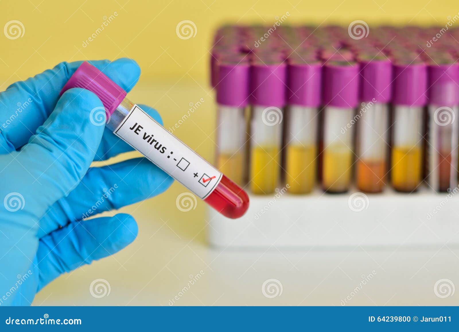 JE virus blood sample stock photo. Image of laboratory - 64239800