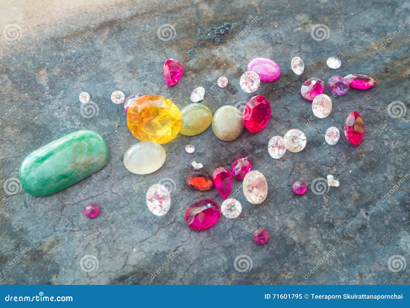 An Endoscopic View Of The Colon With Marked Areas Of Interest For