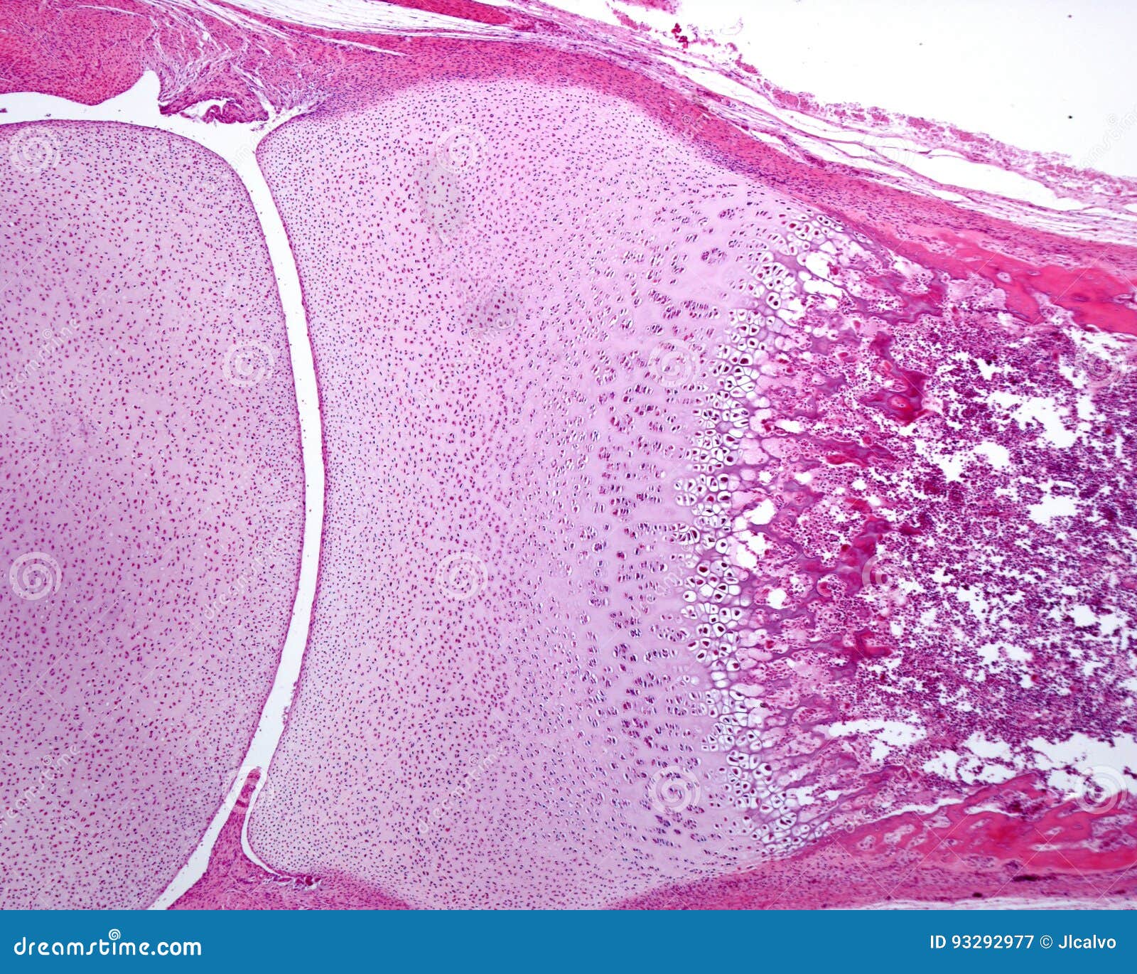 Joint D Os Image Stock Image Du Centre Cartilage Ossification