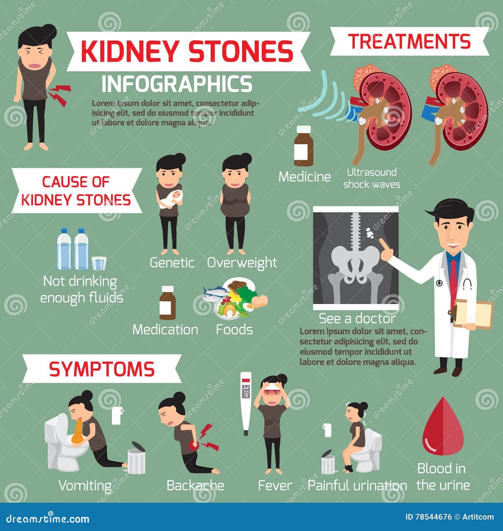 Kidney Stone Infographic Detail Medical Set Elements Stock Vector