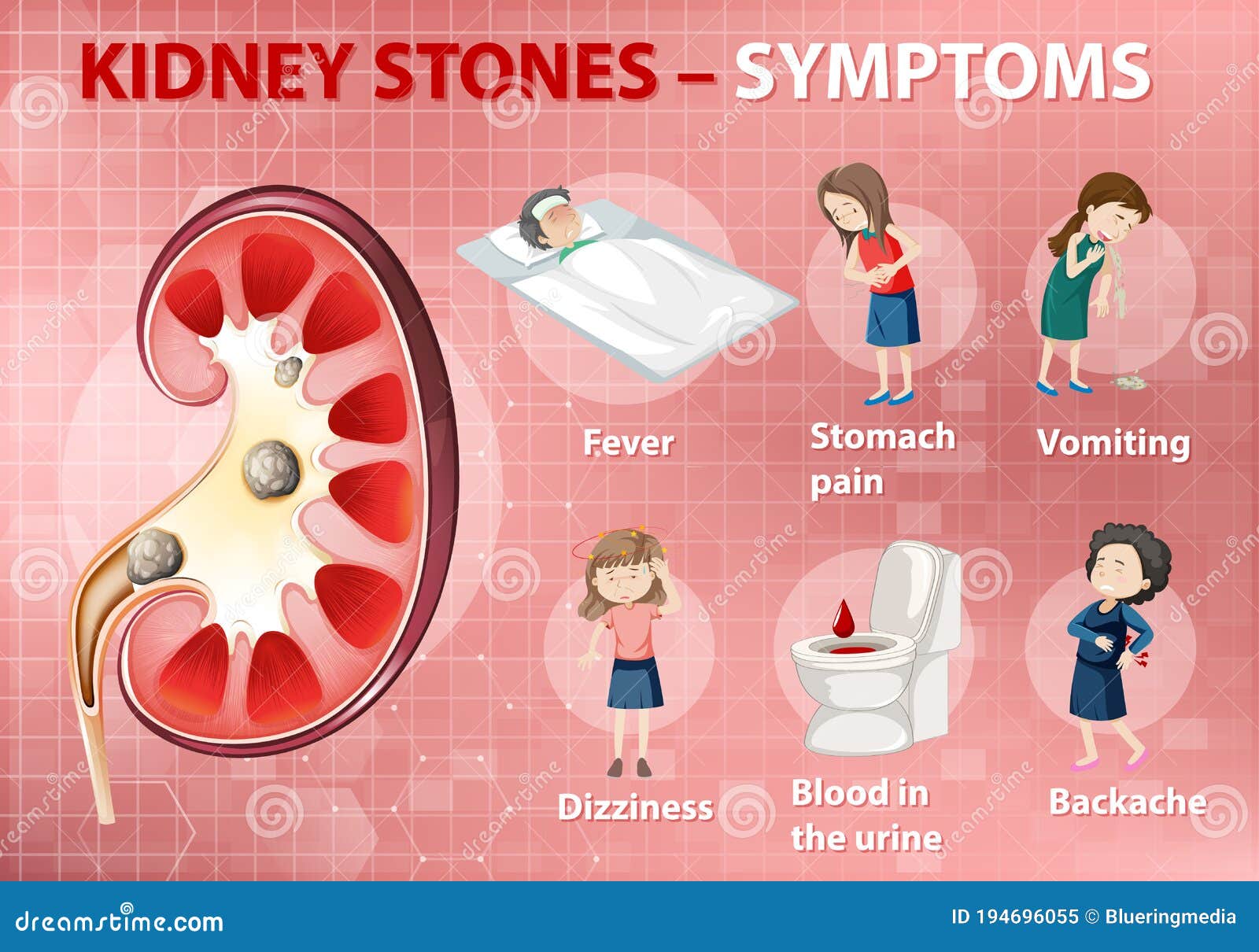 Symptoms Of Stones In The Gallbladder. Infographics. Vector
