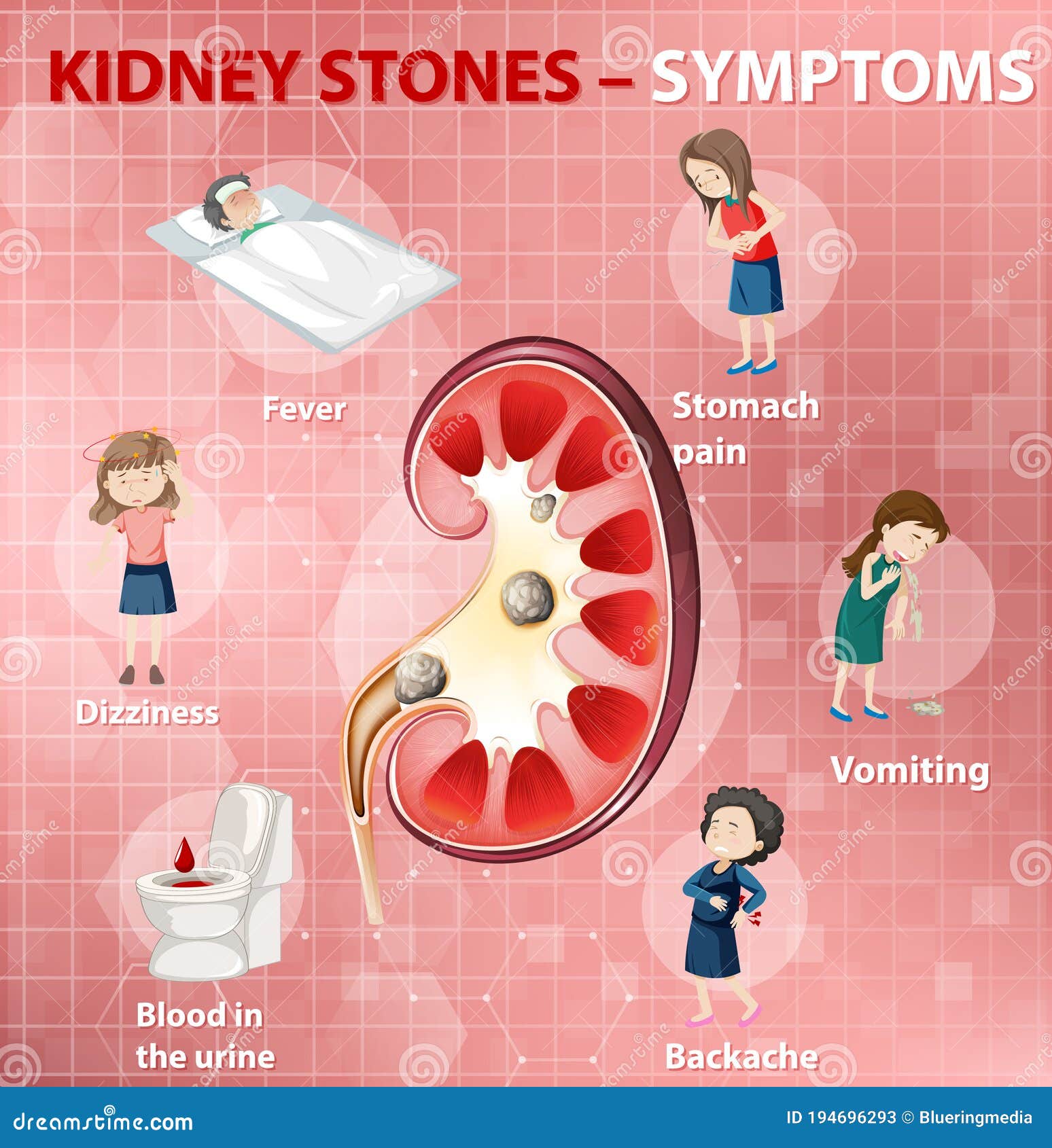Kidney Stones Symptoms Cartoon Style Infographic Stock Vector