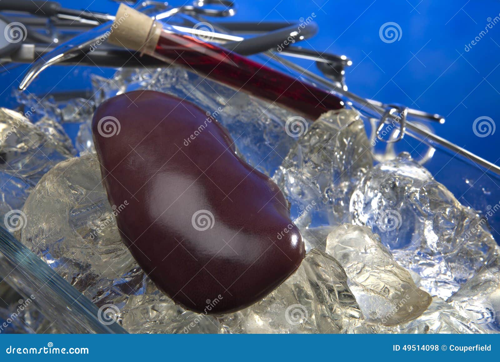 Kidney for Transplantation on Ice in Studio Stock Photo Image of
