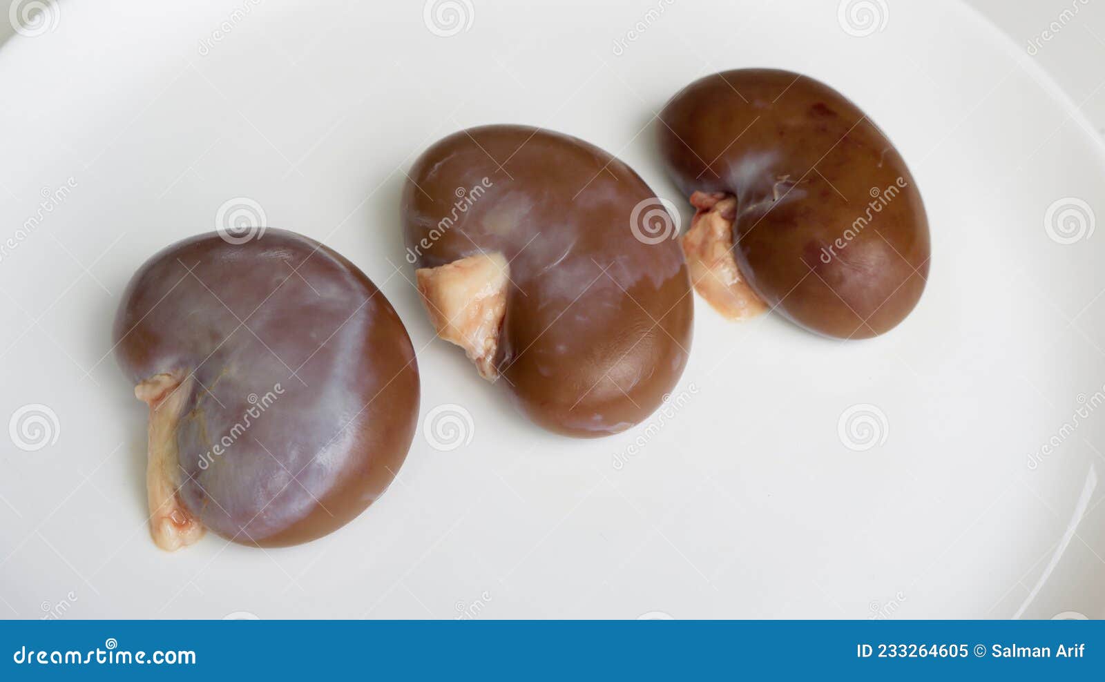 Plain XRay Of Urinary Tract Kidney, Ureter And Urinary Bladder