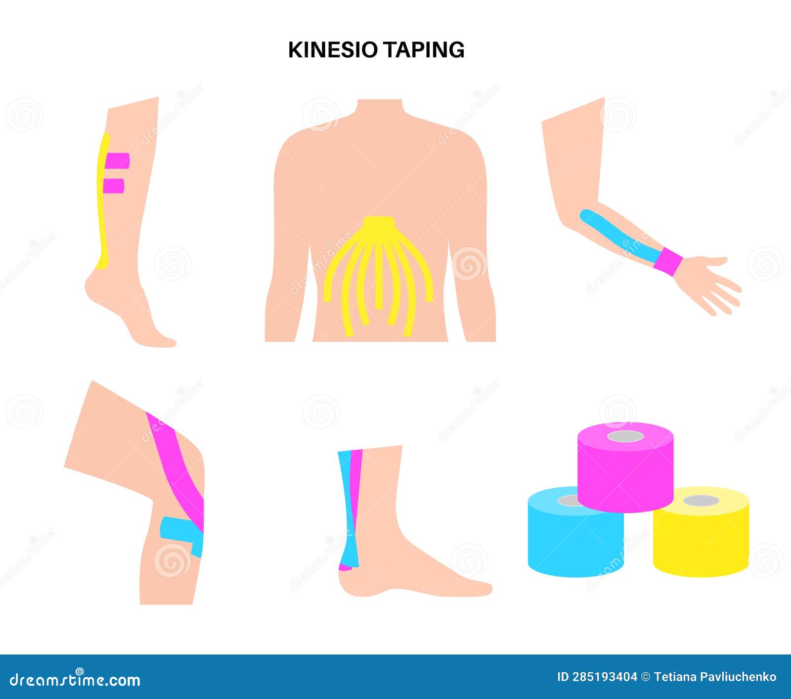 Kinesiology Therapeutic Tape Stock Illustration Illustration of care
