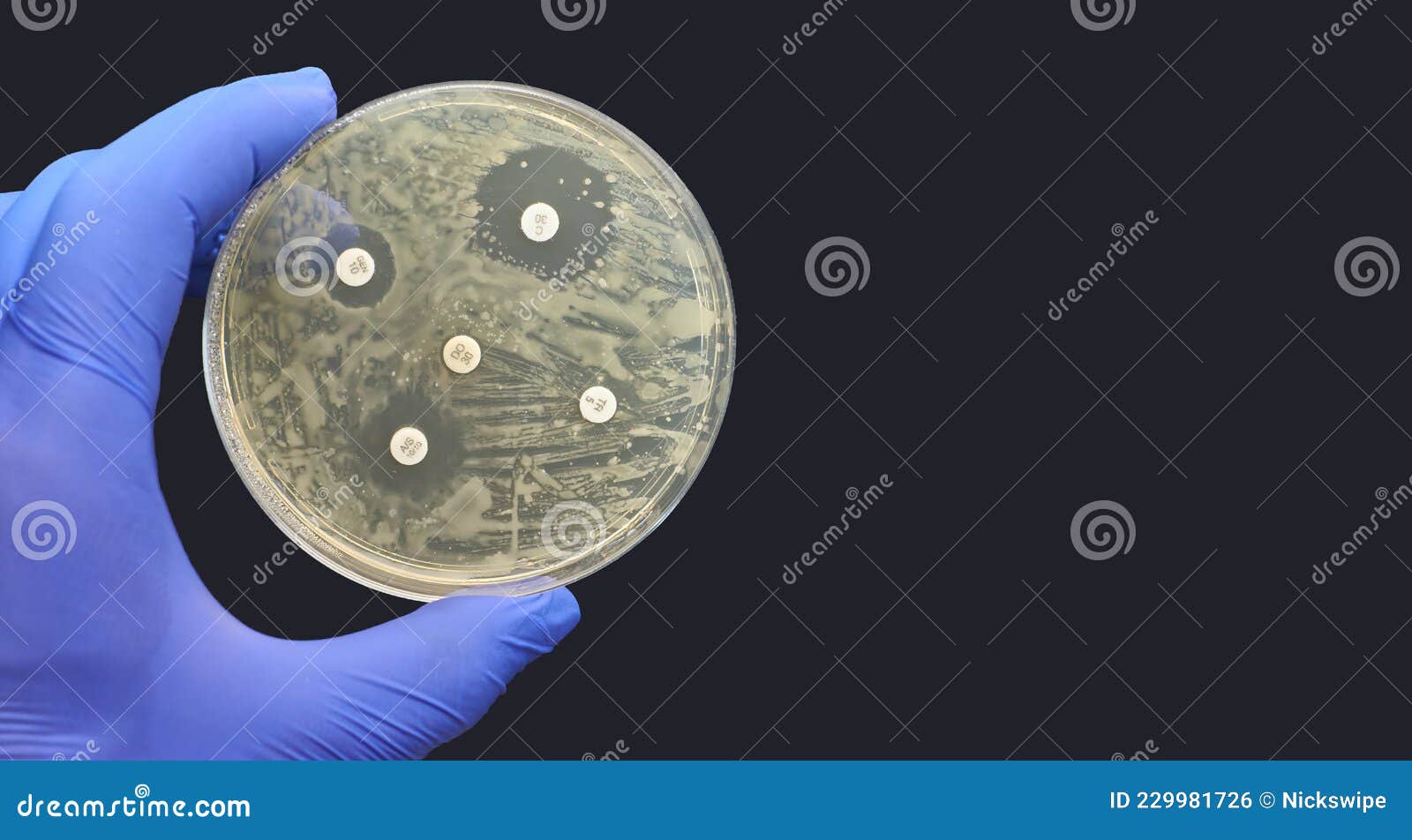 Kirby-Bauer Disk Diffusion Antimicrobial Susceptibility Test Black  Background Stock Photo - Image of resistance, healthcare: 229981726