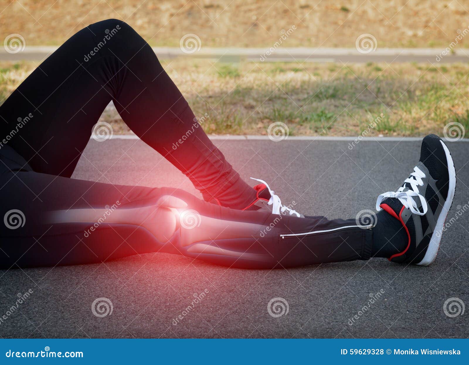 Knee injury stock photo. Image of exercise, bone, marathon 59629328