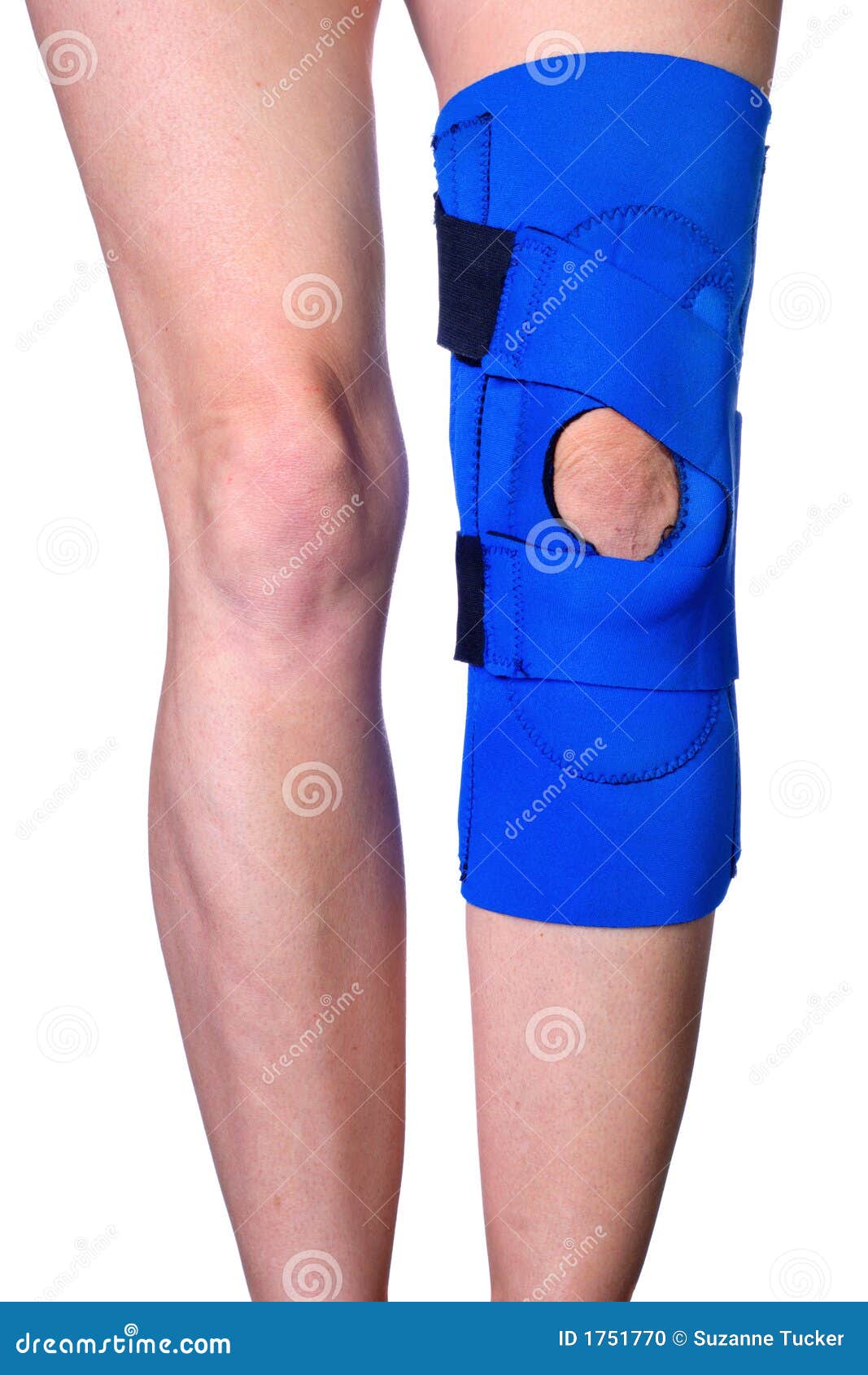 Knee in Knee Brace after an Injury Stock Photo Image of sports