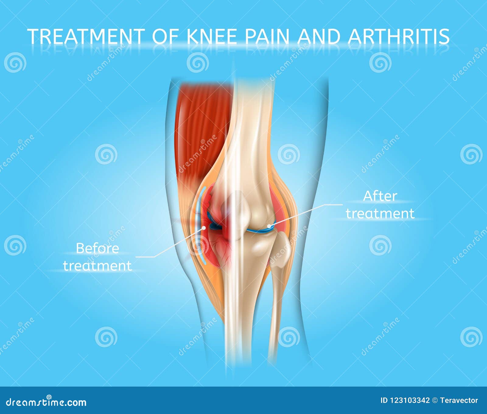 Knee Injury Chart