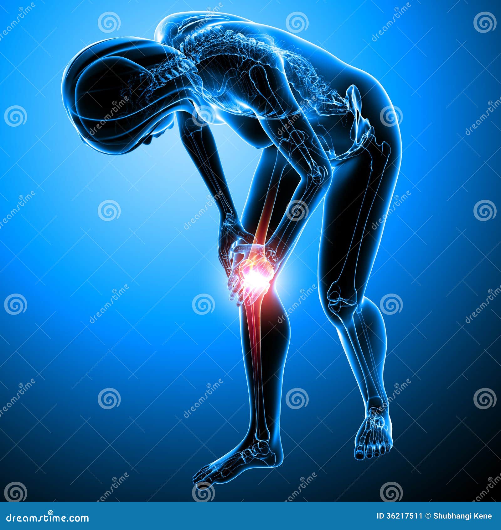 Injury Of Knee Bone And Leg While Running Cartoon Vector