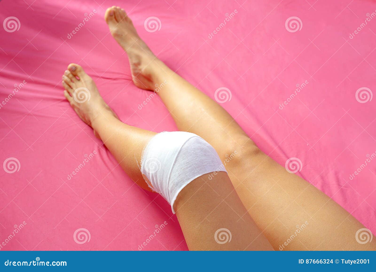 Knee Replacement Surgery after Operation Patient on the Bed in Hospital