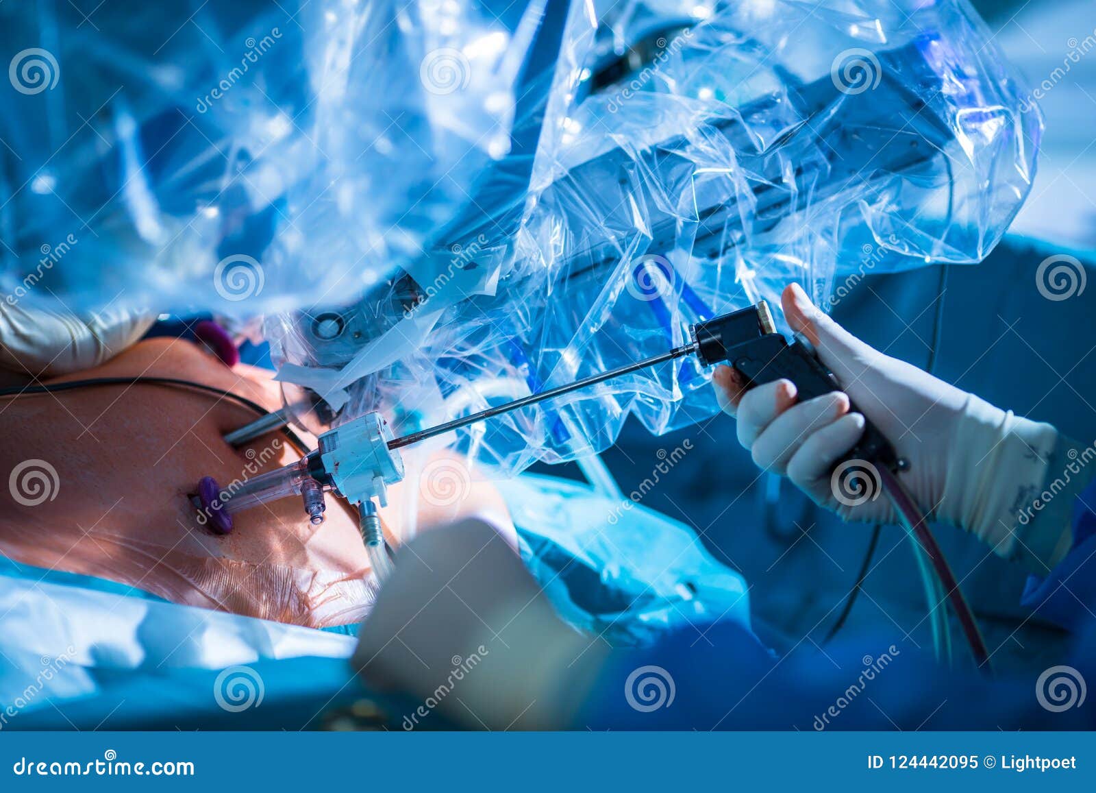 Knee Surgery Anaesthetic Injection Stock Image CartoonDealer knee-surgery-anaesthetic-injection-stock-image-cartoondealer