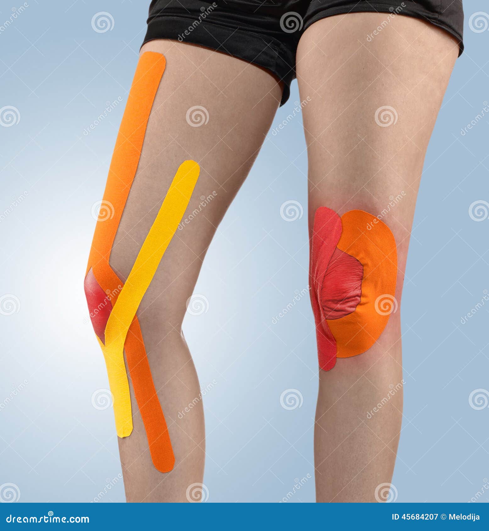 Knee Treated with Tape Therapy Stock Image Image of patient, athletic