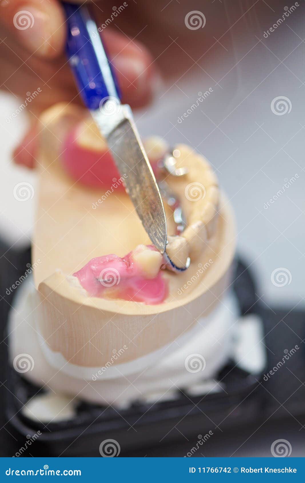Knife on dentures stock photo. Image of denture, crown 11766742