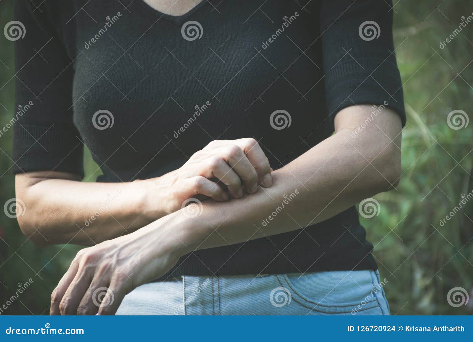 Kvinnaskrapaklåda med handen Kvinnlig som skrapar hennes arm Healthc. Kvinnaskrapaklåda med handen Kvinnlig som skrapar hennes arm Sjukvård och smärtsamt begrepp