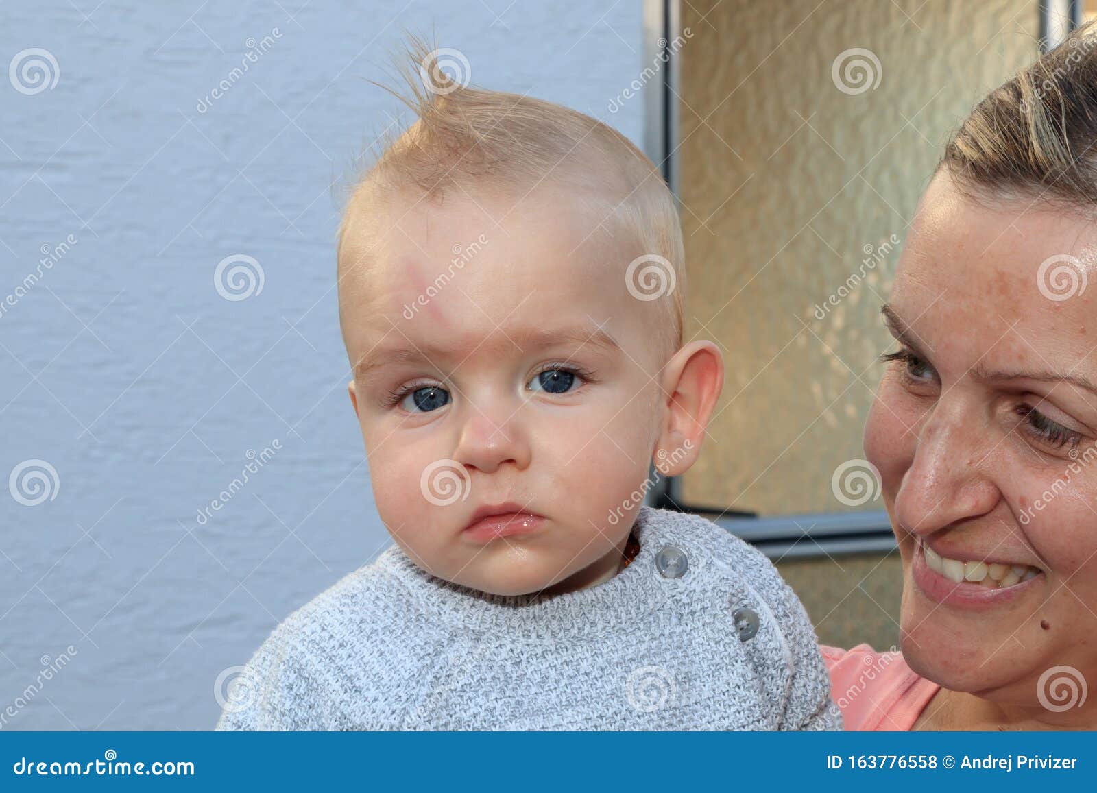 L Expression Du Bebe Et La Cicatrice Sur Le Front Apres Qu Il A Frappe La Tete Au Sol Photo Stock Image Du Oeil Beau