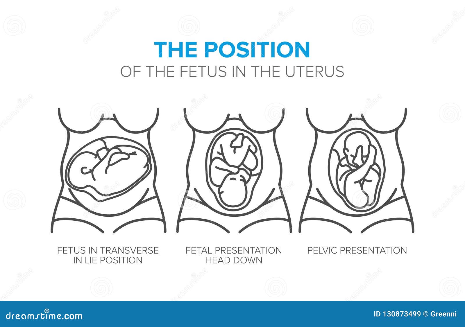 La Position Du Foetus Dans L Uterus Illustration De Vecteur Illustration Du Embryon Oeuf La Position Du Foetus Dans L Uterus Illustration De Vecteur Illustration Du Embryon Oeuf