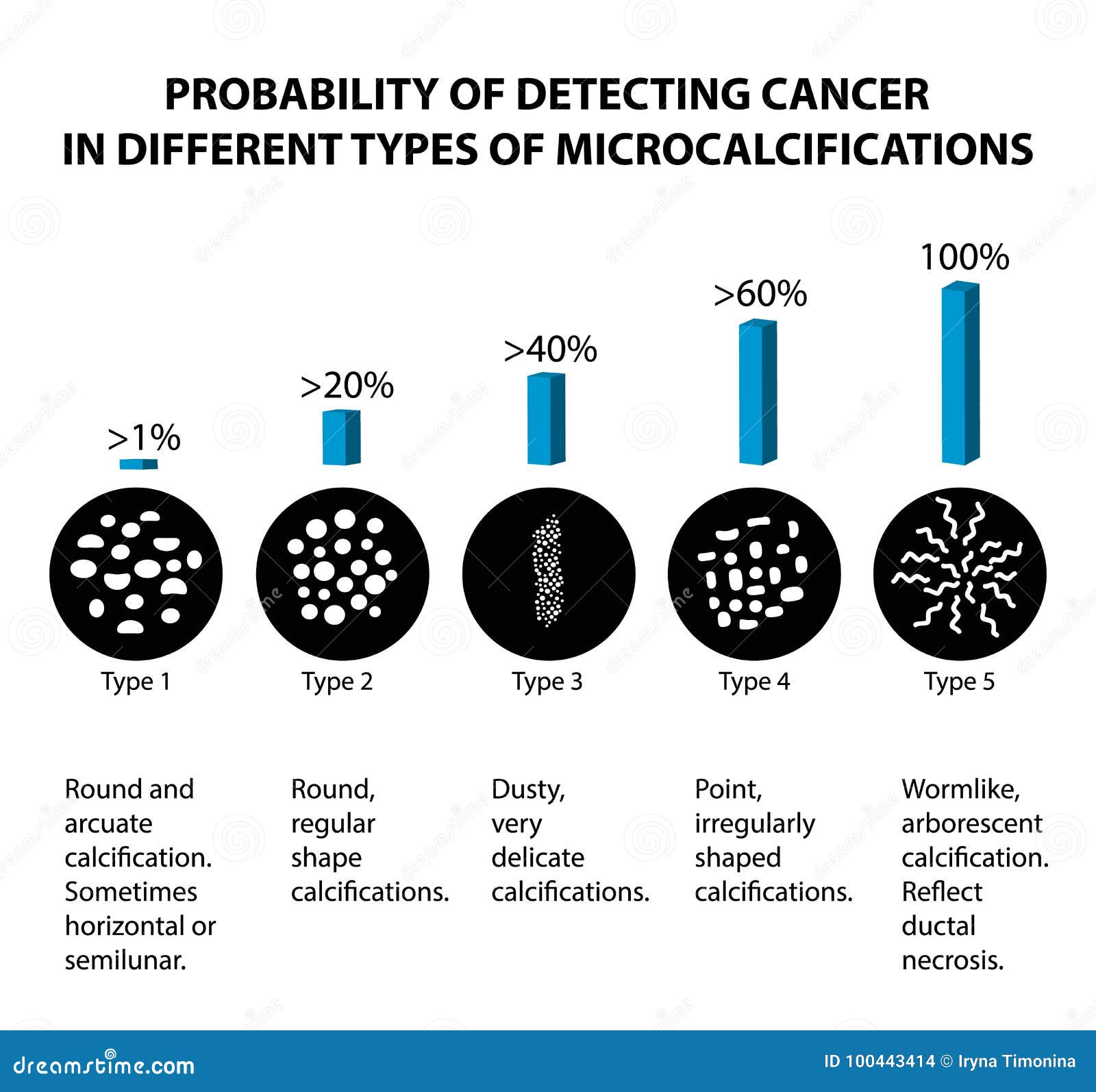 La Probabilité De Détecter Le Cancer Du Sein Avec Différents Types ...