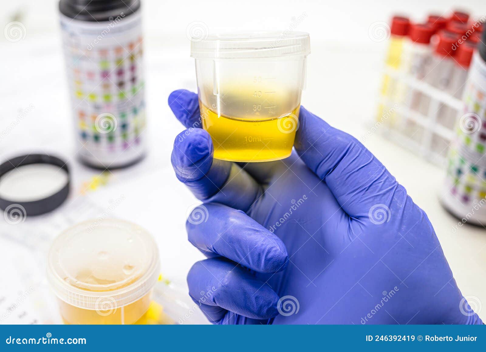 laboratorian hand with glove, performing eas type urine test, abnormal sediment s