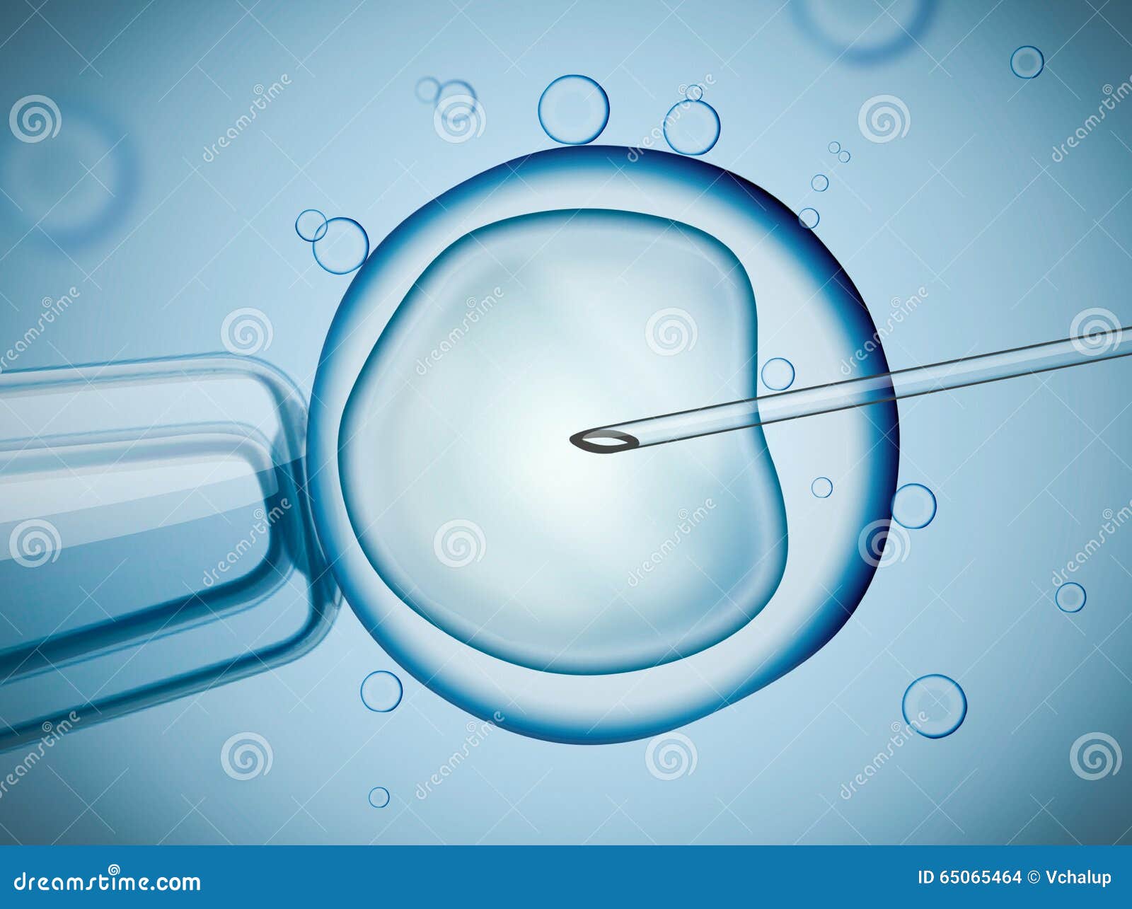 laboratory microscopic research of ivf (in vitro fertilization).