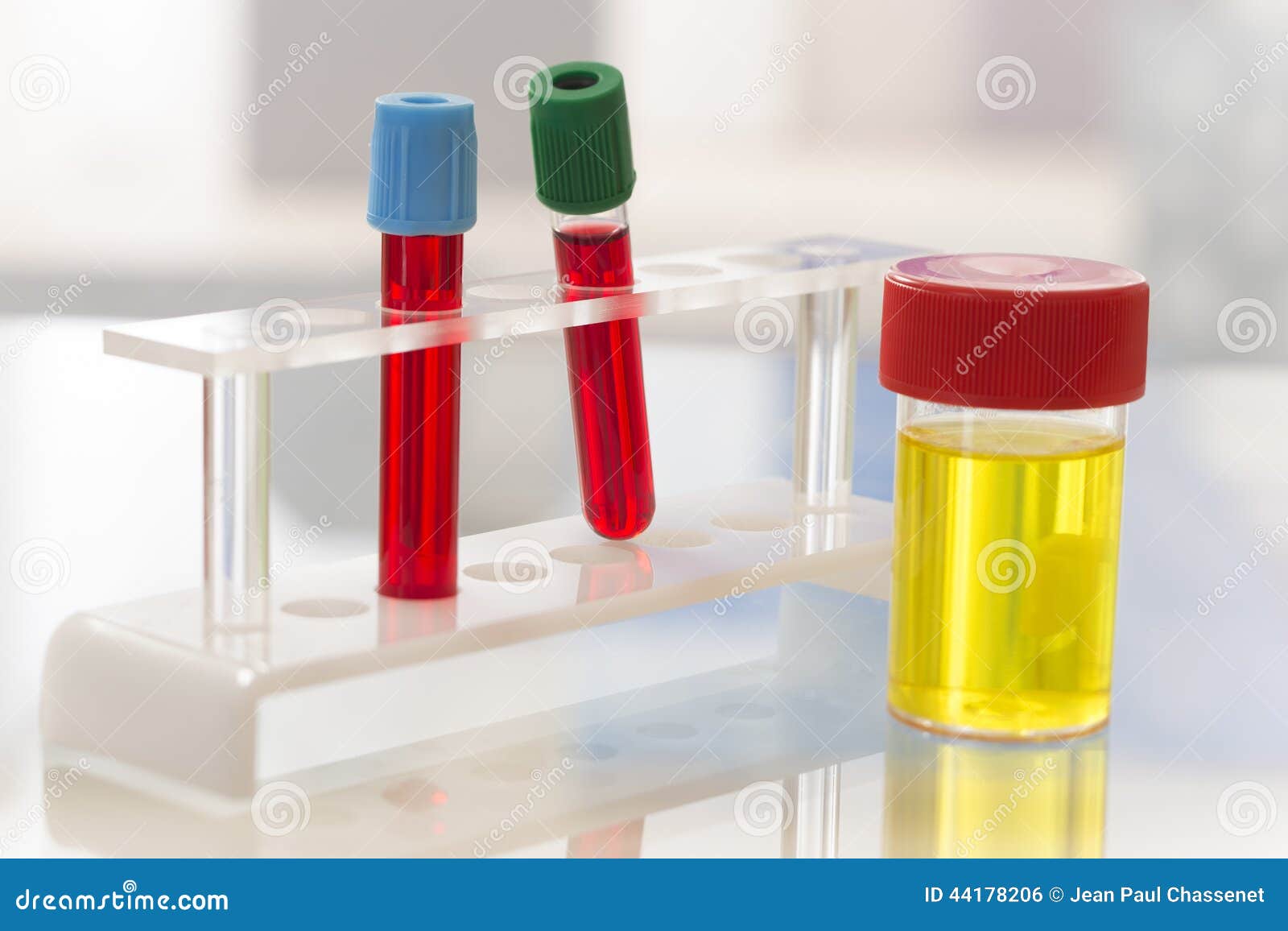 Urine And Blood Test complete Blood Count Royalty Free Stock Image CartoonDealer 76037686 urine-and-blood-test-complete-blood-count-royalty-free-stock-image-cartoondealer-76037686