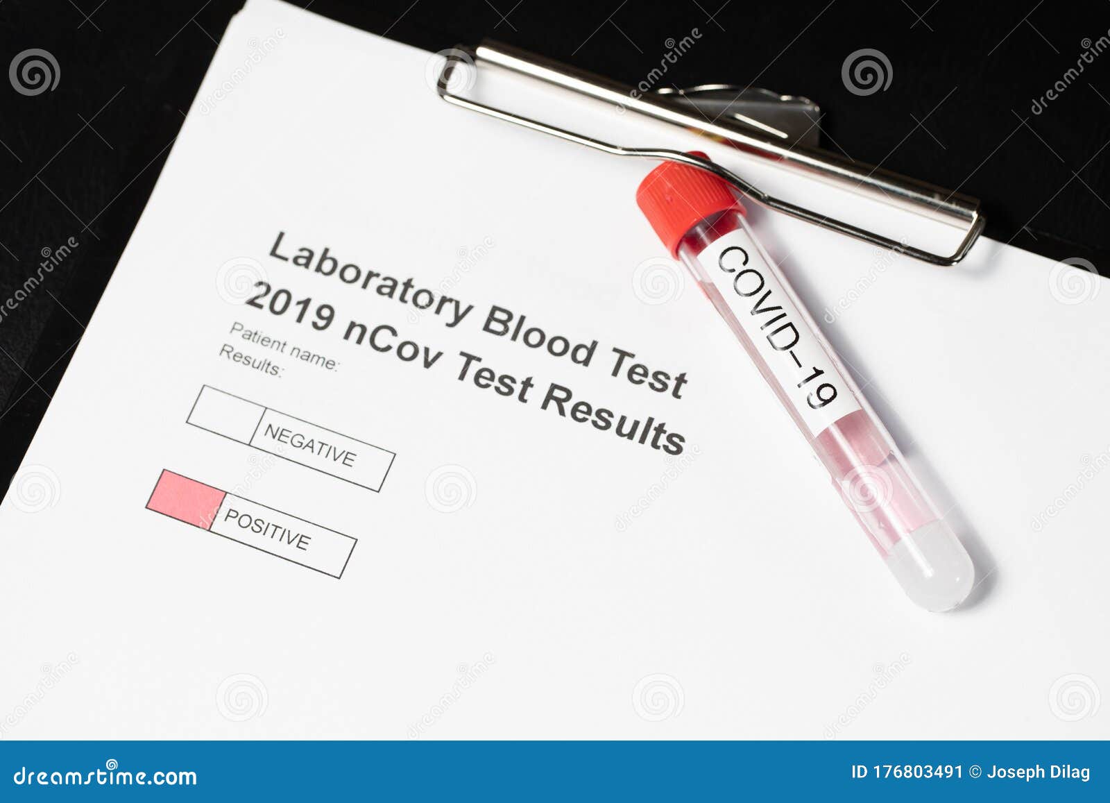testing kit for ncov, covid - 19, corona virus testing tube in laboratory