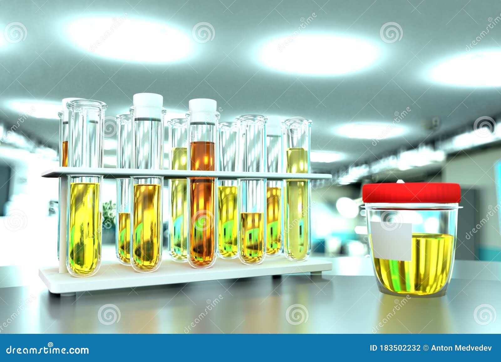 Laboratory Test Tubes in Modern Pollution Facility Urine Quality Test for Specific Gravity or