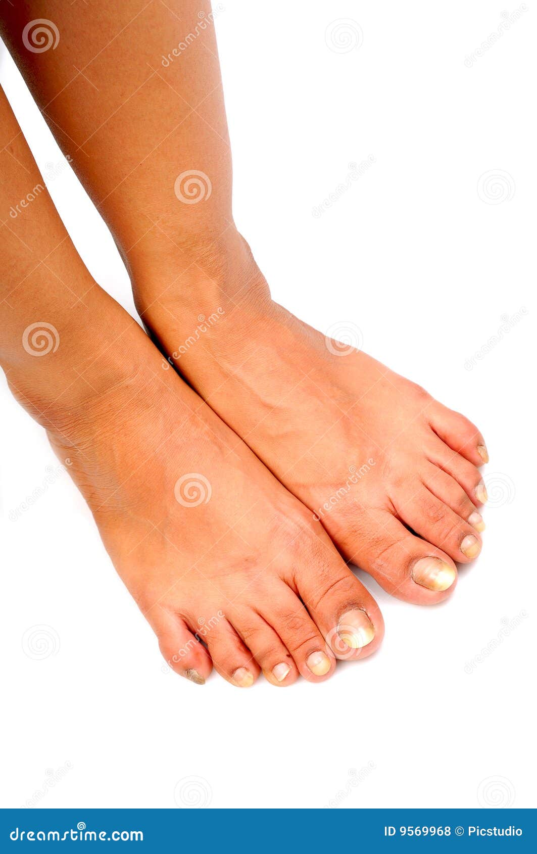 Lady Feet Pics