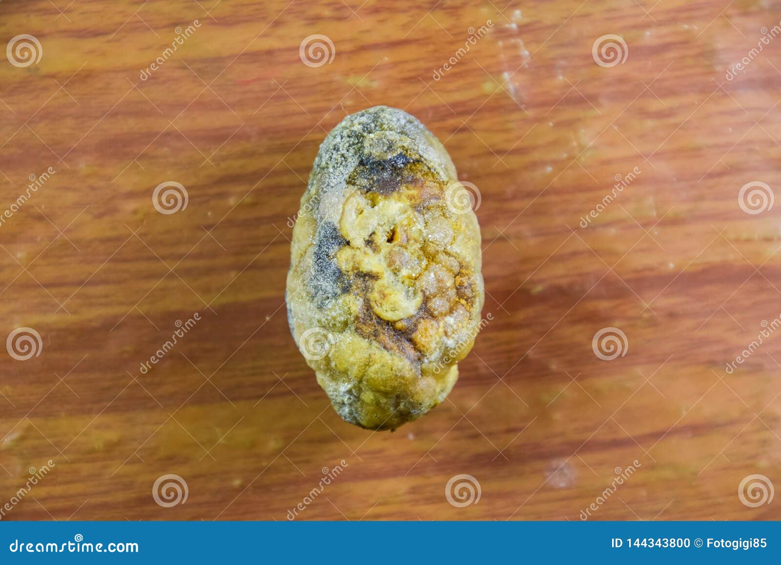Large Gallstone Gall Bladder Stone The Result Of Gallstones Stock large-gallstone-gall-bladder-stone-the-result-of-gallstones-stock
