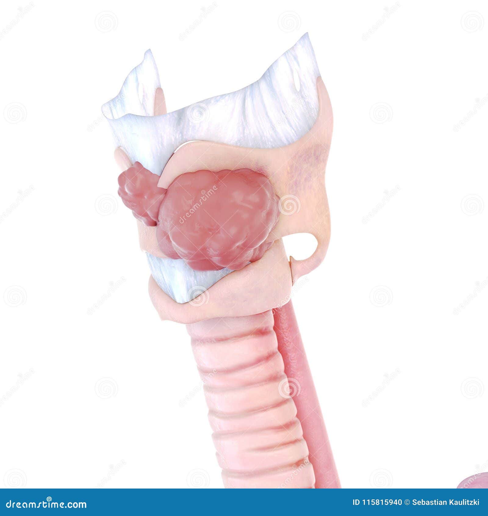 Larynx cancer stock illustration. Illustration of body ...