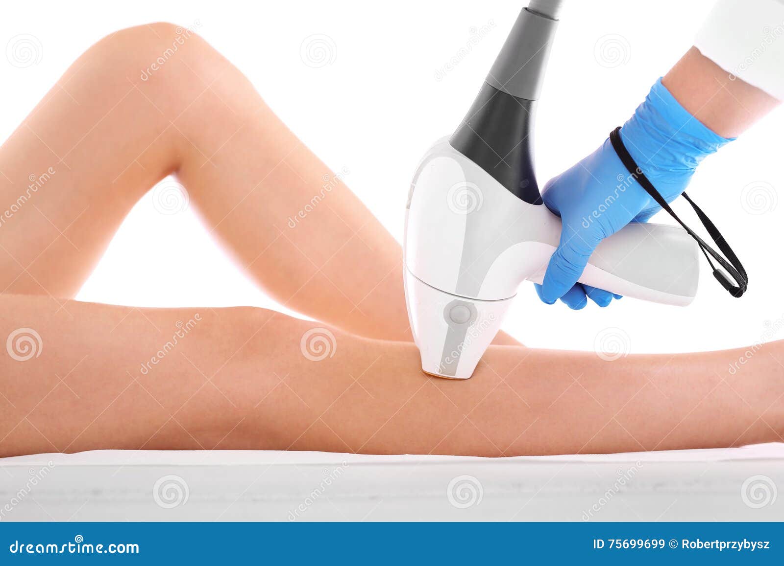 laser hair removal