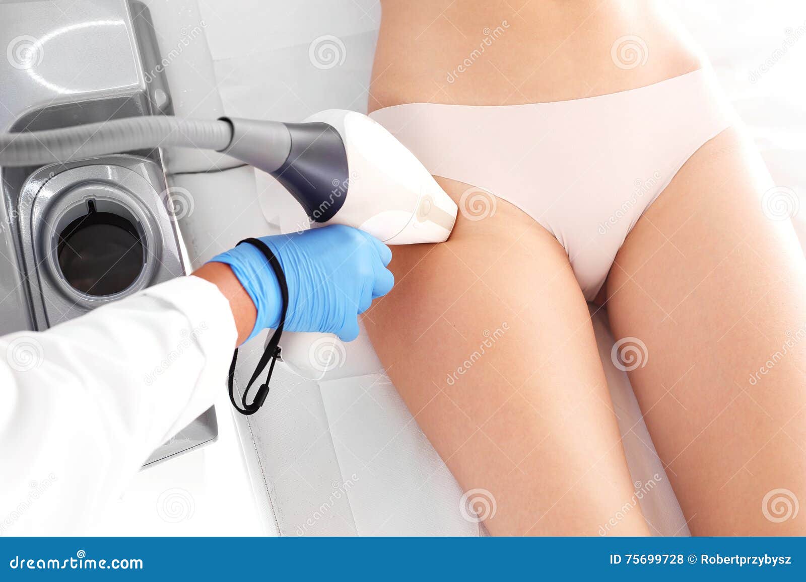 laser hair removal