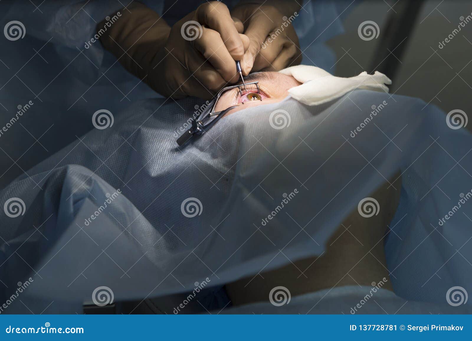 Laser Surgery for Vision Correction Stock Image Image of clinic