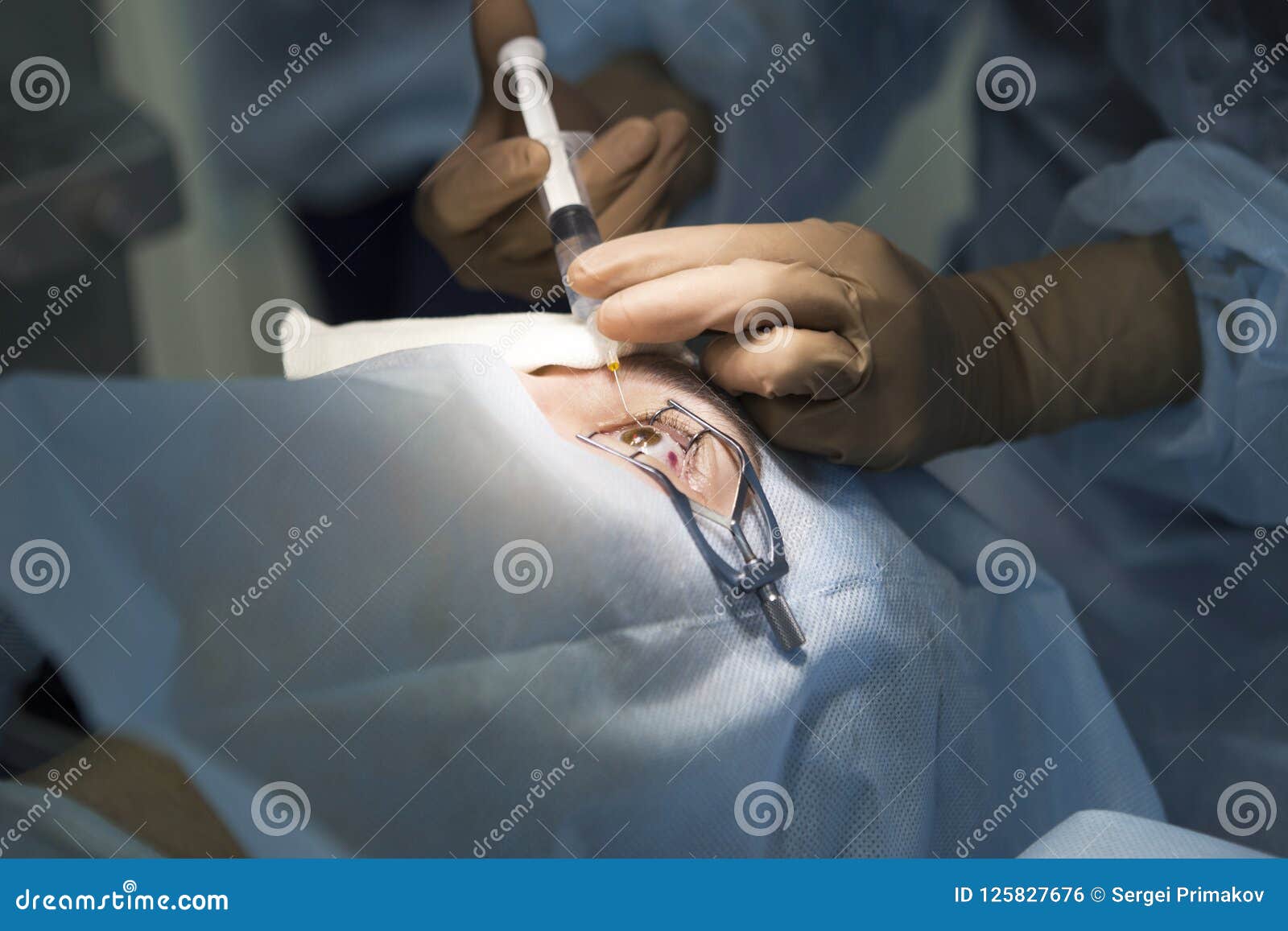 Laser Surgery for Vision Correction Editorial Photo Image of health