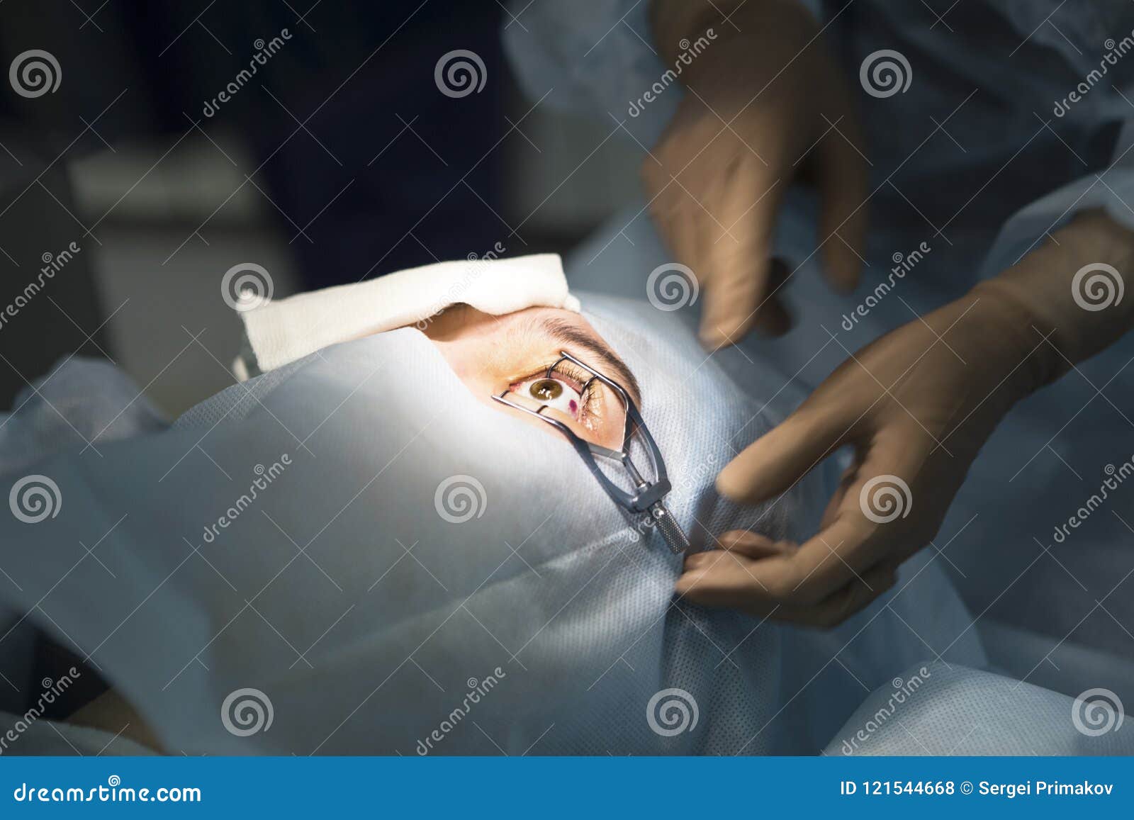 Laser Surgery for Vision Correction Stock Photo Image of cataract