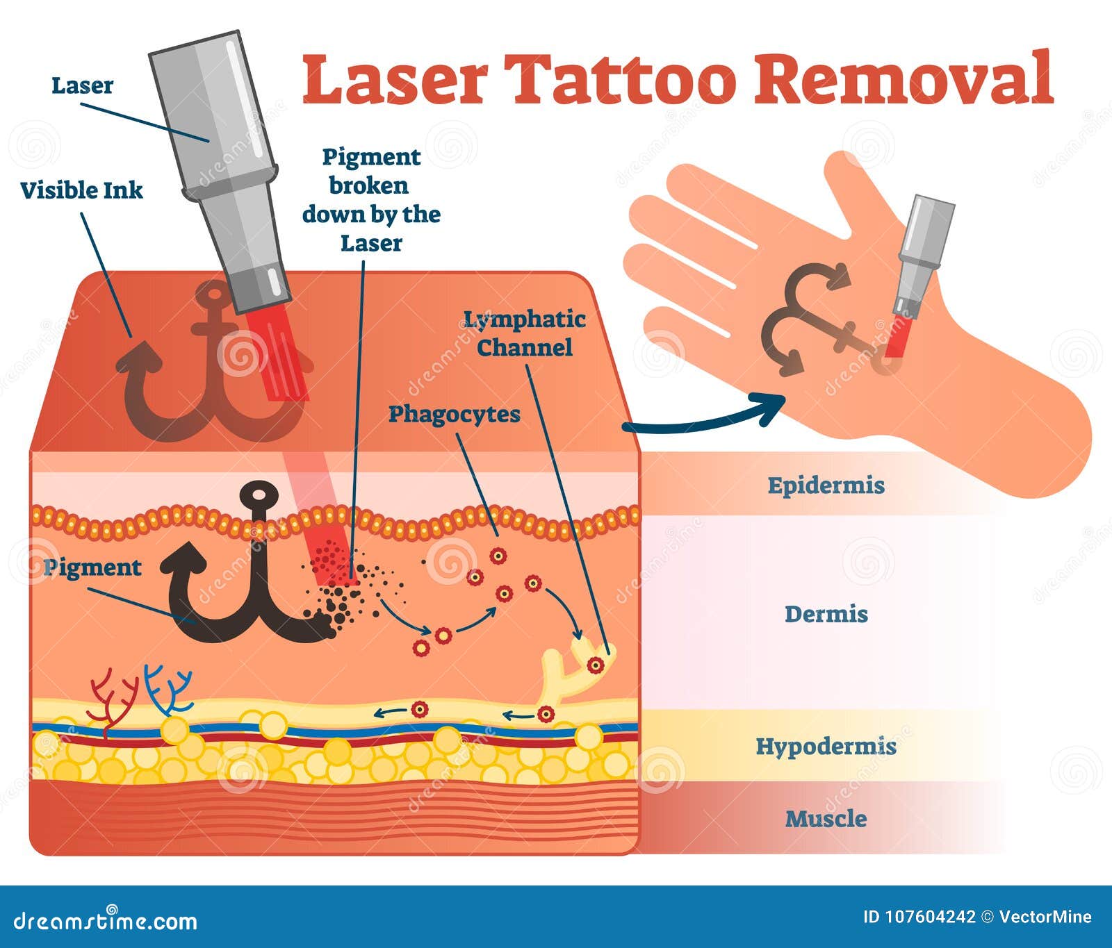 How Much Do Tattoos Actually Hurt? We Asked a Dermatologist