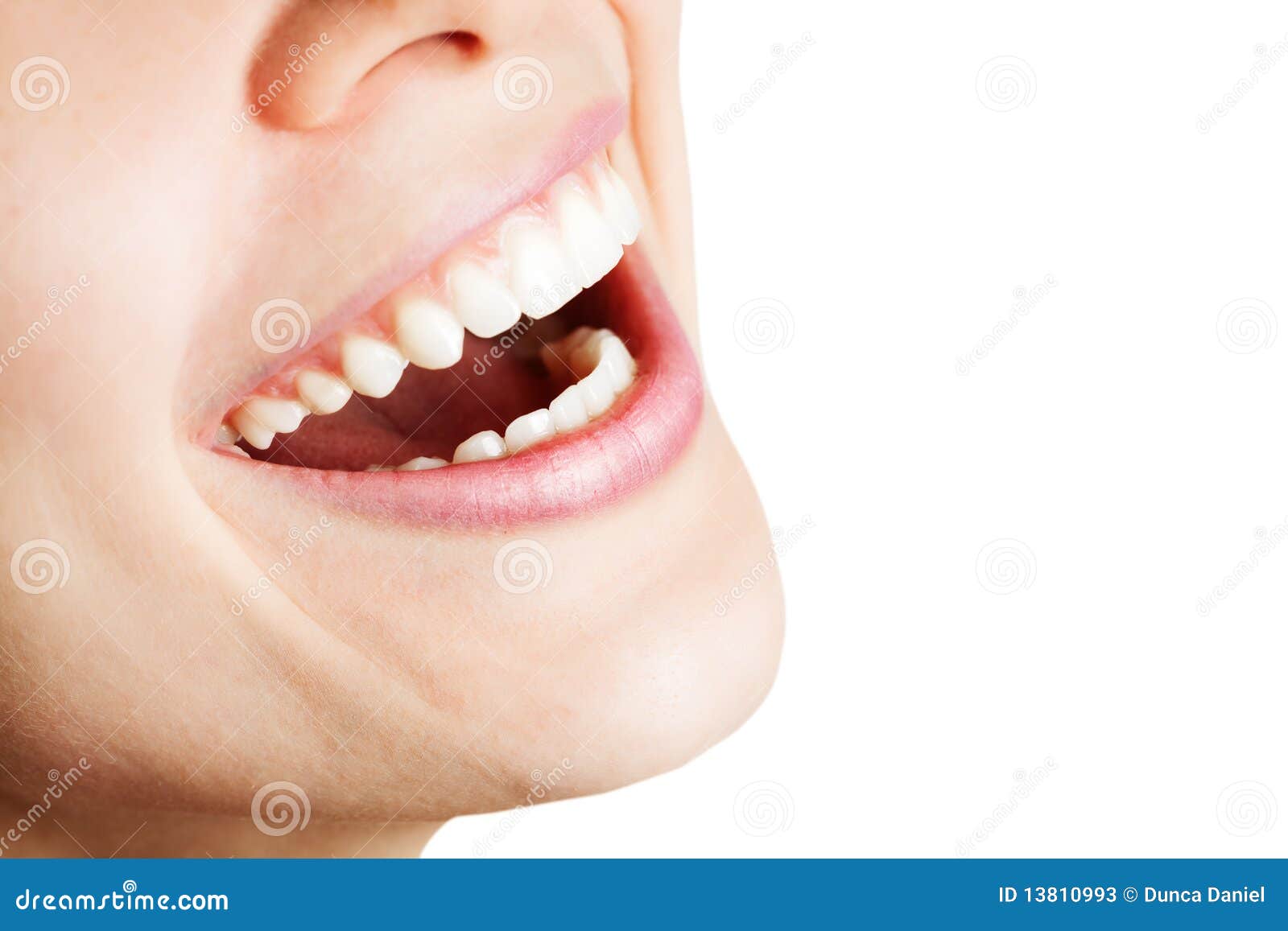 laugh of happy woman with healthy teeth