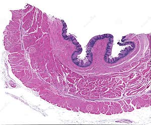 Esophagus Submucosa Connective Tissue Stock Photo CartoonDealer 