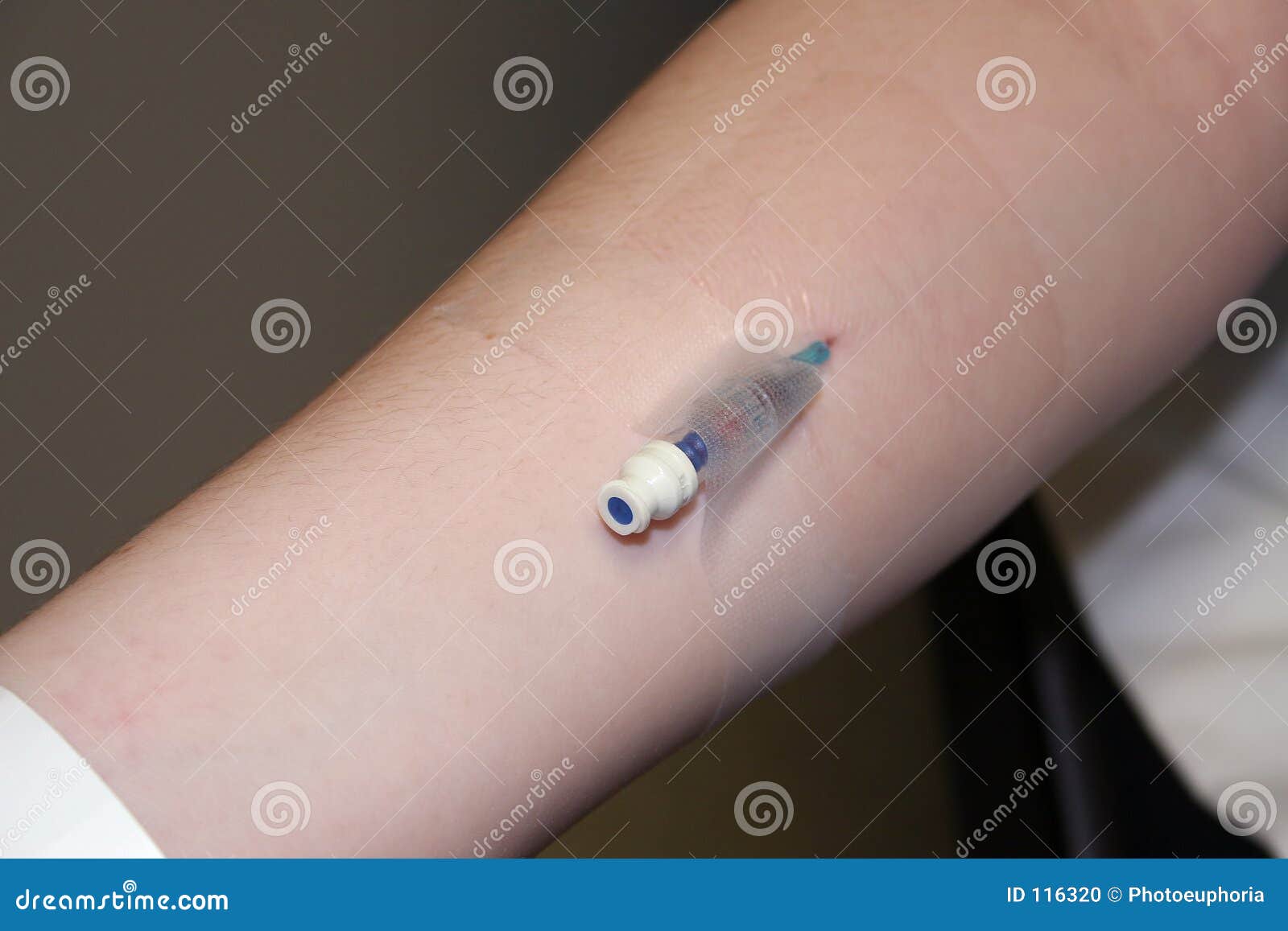 Le Bras De L'enfant Avec IV Le Cathéter Inséré Photo stock Image 116320