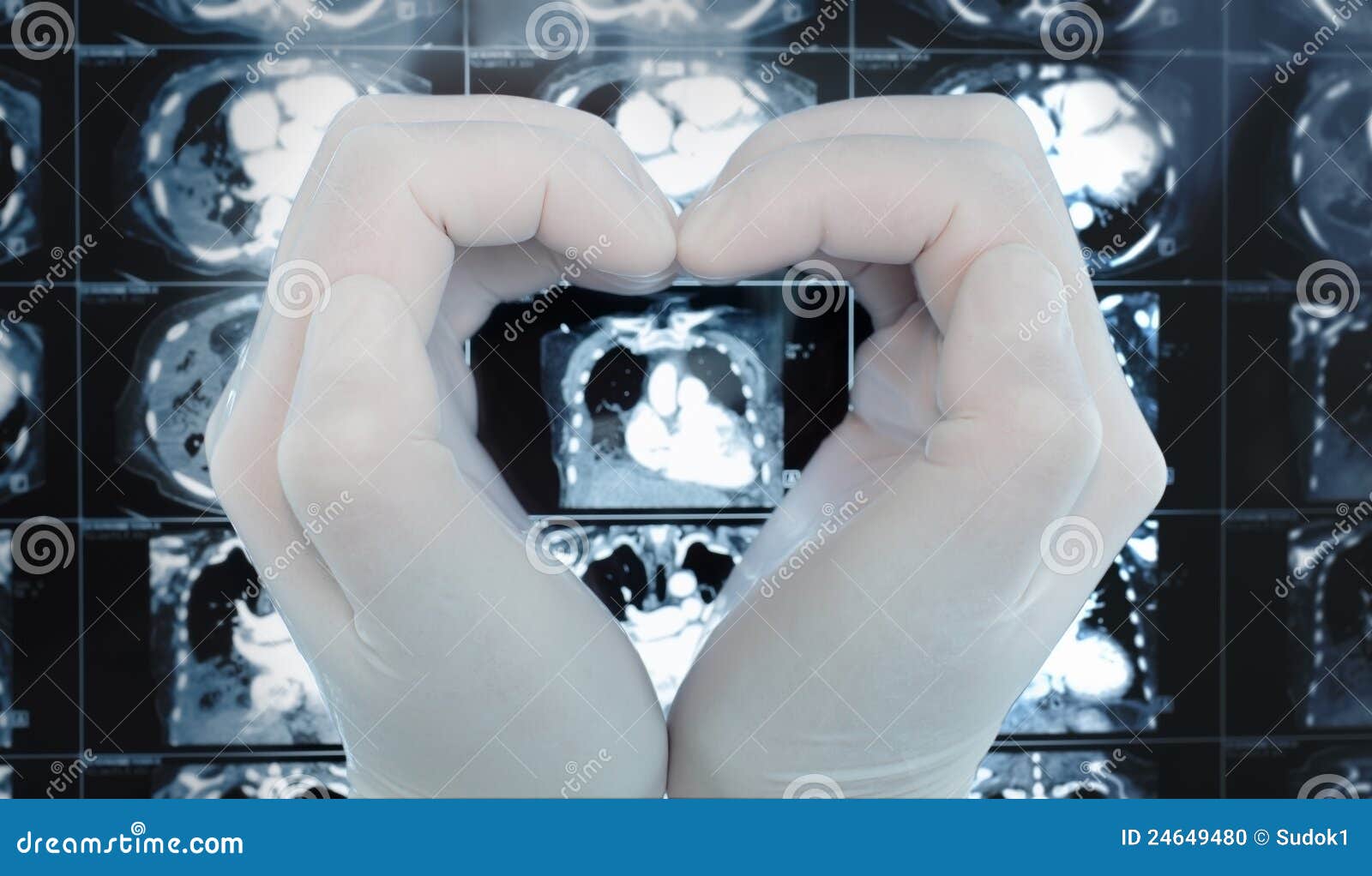 Le mani fanno un cuore che abbraccia l'immagine sulla ricerca di CT. La mano fa un cuore che abbraccia l'immagine sulla ricerca di CT. Professione di simbolo nella medicina, amore del suo lavoro.