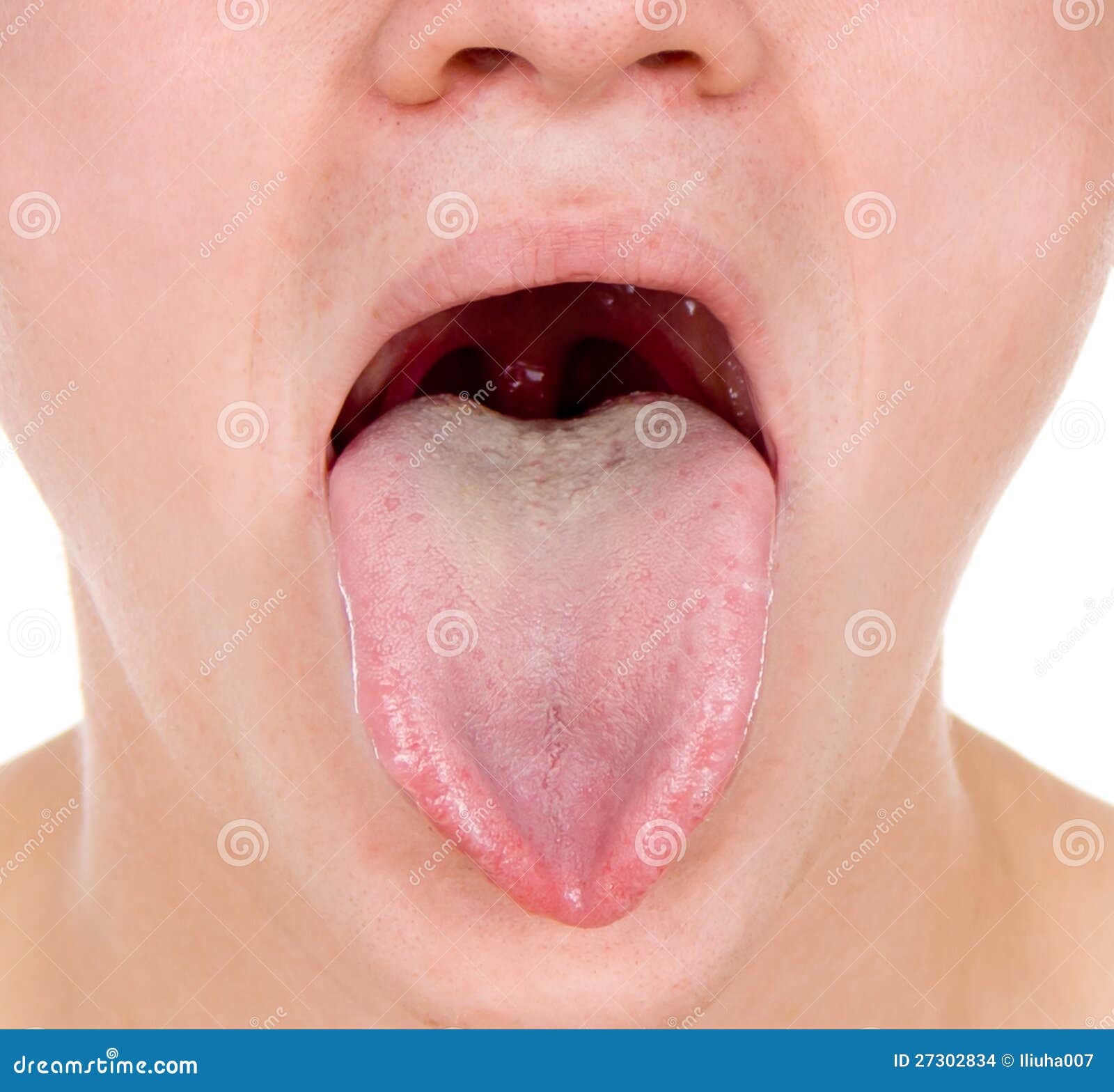 Le Type Affiche Sa Gorge, Langue Photo stock - Image du oral ...