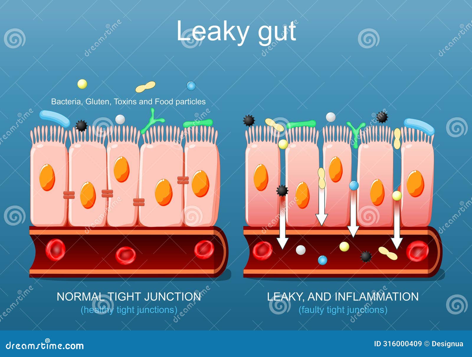 leaky gut. close-up of cells of a intestinal epithelium