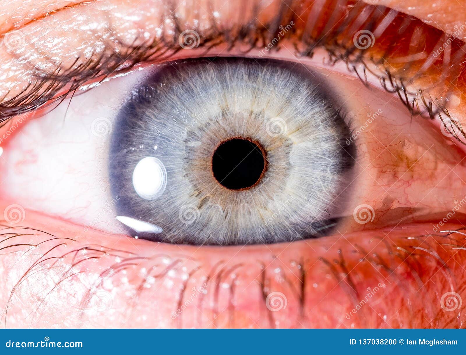 close up eye. close up iris. very close macro shot of an eyeball. pale blue and white with black rim with crater